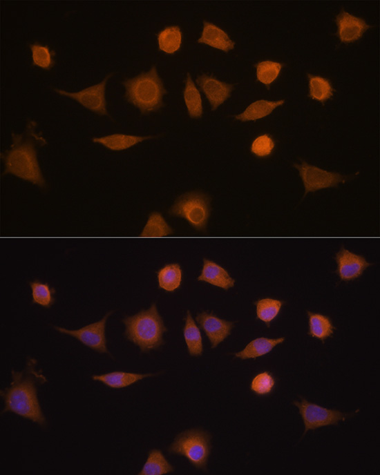 GSTA1 Rabbit polyclonal antibody
