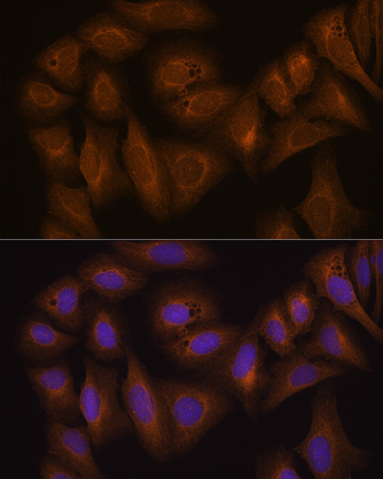 GSTA1 Rabbit polyclonal antibody