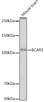 BCAR1 Rabbit polyclonal antibody