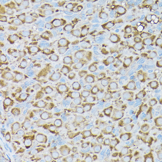 BCAR1 Rabbit polyclonal antibody