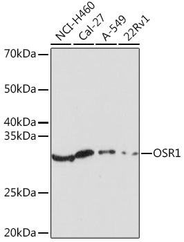 OSR1 Rabbit polyclonal antibody