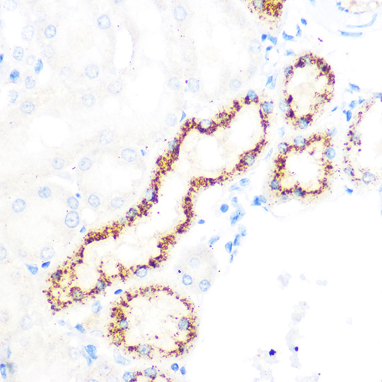 OSR1 Rabbit polyclonal antibody