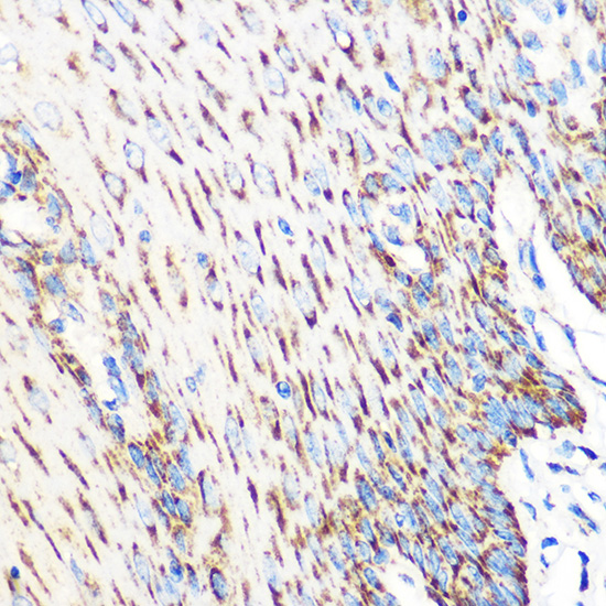 OSR1 Rabbit polyclonal antibody