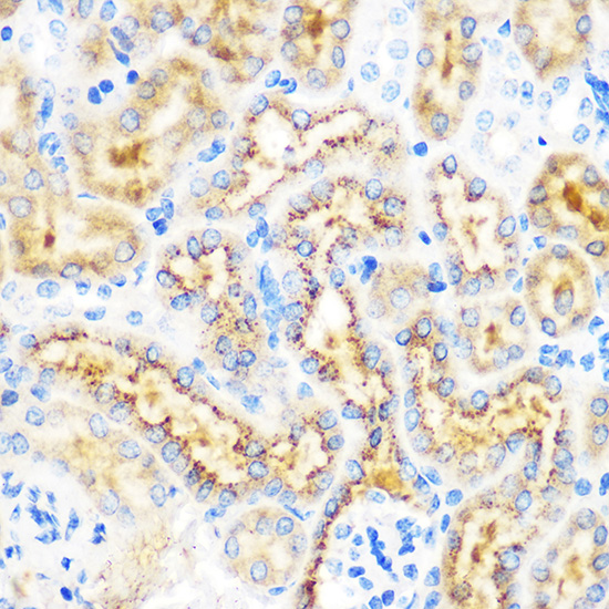 OSR1 Rabbit polyclonal antibody