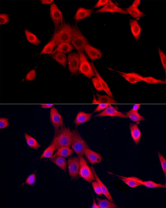 MEIS1 Rabbit polyclonal antibody