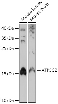 ATP5G2 Rabbit polyclonal antibody