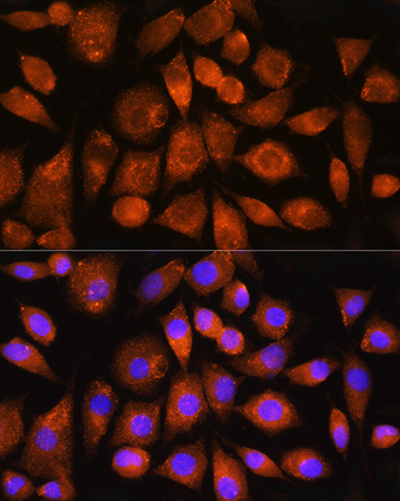 ATP5G2 Rabbit polyclonal antibody