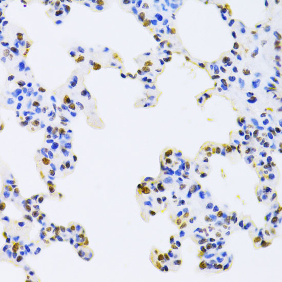 HNRNPD Rabbit polyclonal antibody