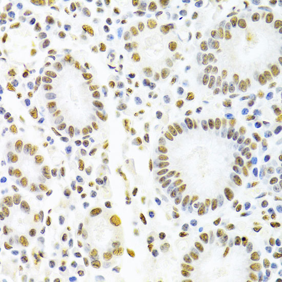 HNRNPD Rabbit polyclonal antibody