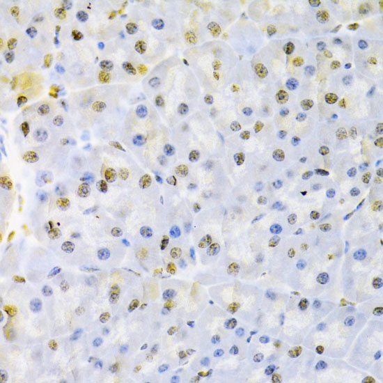 HNRNPD Rabbit polyclonal antibody