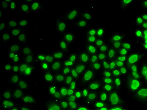 HNRNPD Rabbit polyclonal antibody