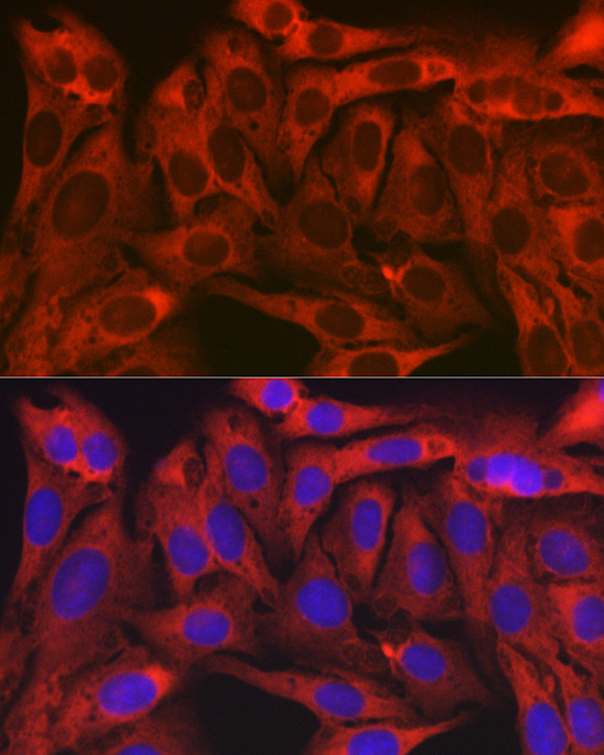 TXLNA Rabbit polyclonal antibody
