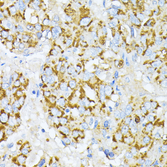Peroxiredoxin 4 (PRDX4) Rabbit polyclonal antibody