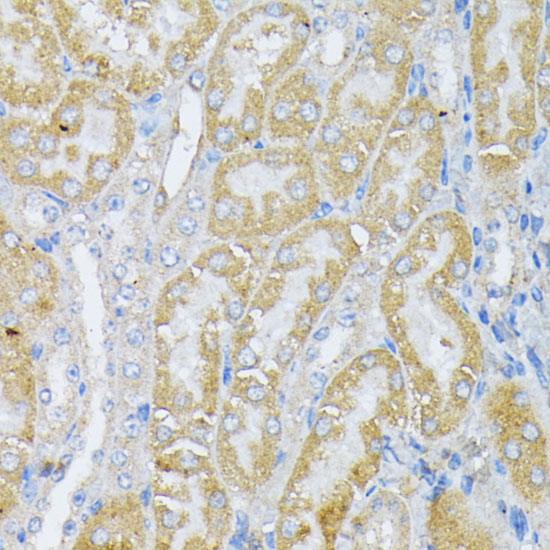 Peroxiredoxin 4 (PRDX4) Rabbit polyclonal antibody