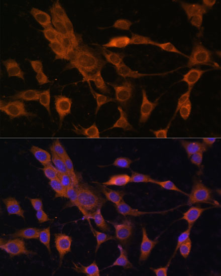 Peroxiredoxin 4 (PRDX4) Rabbit polyclonal antibody