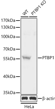 [KO Validated] PTBP1 Rabbit polyclonal antibody