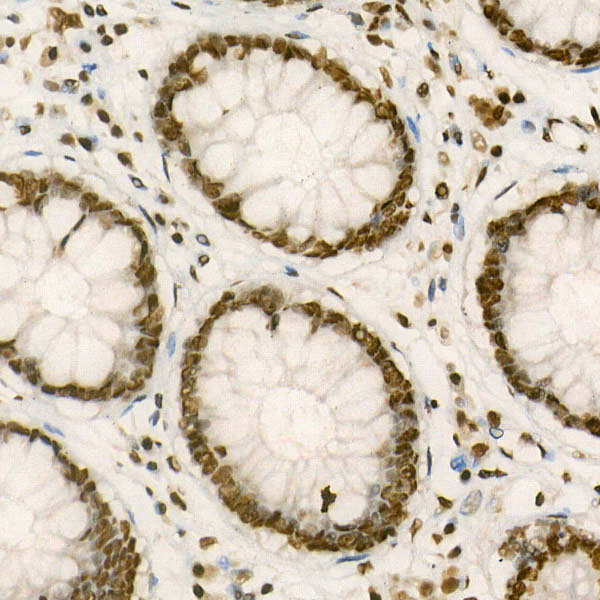 [KO Validated] PTBP1 Rabbit polyclonal antibody
