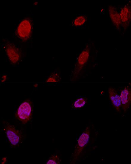 [KO Validated] PTBP1 Rabbit polyclonal antibody