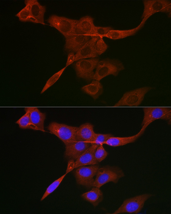 JAK1 Rabbit polyclonal antibody