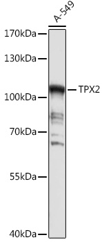 TPX2 Rabbit polyclonal antibody