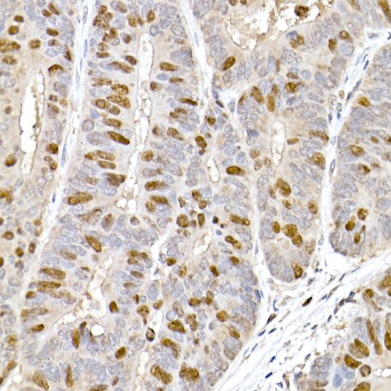 TPX2 Rabbit polyclonal antibody