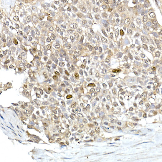 TPX2 Rabbit polyclonal antibody