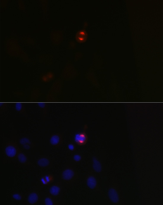 TPX2 Rabbit polyclonal antibody