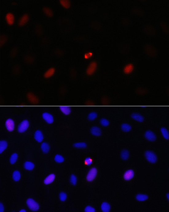 TPX2 Rabbit polyclonal antibody