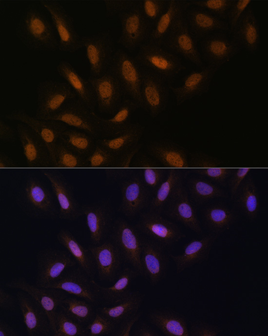 DNA polymerase eta Rabbit polyclonal antibody