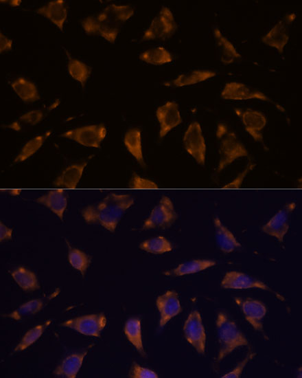 PTRF Rabbit polyclonal antibody