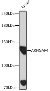 ARHGAP4 Rabbit polyclonal antibody