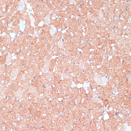 ARHGAP4 Rabbit polyclonal antibody