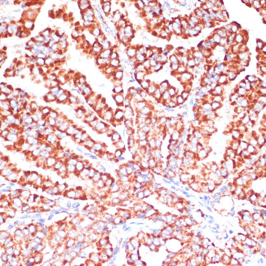 ARHGAP4 Rabbit polyclonal antibody