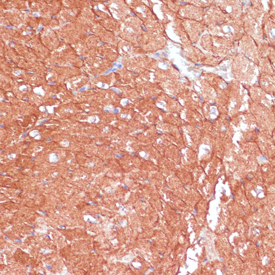 ARHGAP4 Rabbit polyclonal antibody
