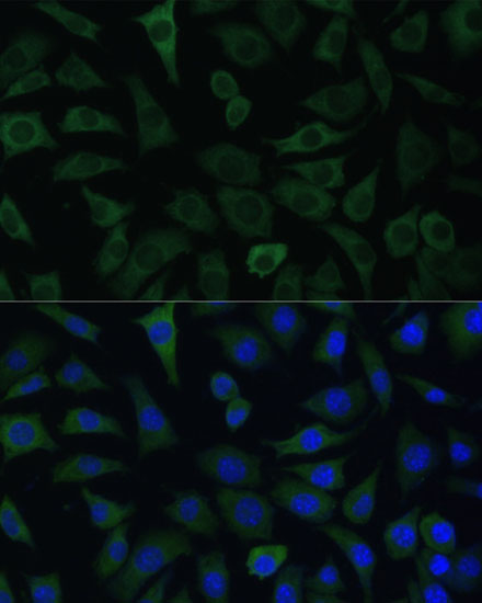 ARHGAP4 Rabbit polyclonal antibody