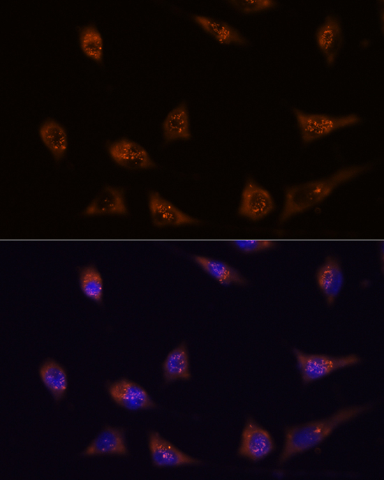 DIP2C Rabbit polyclonal antibody