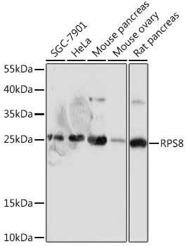 RPS8 Rabbit polyclonal antibody