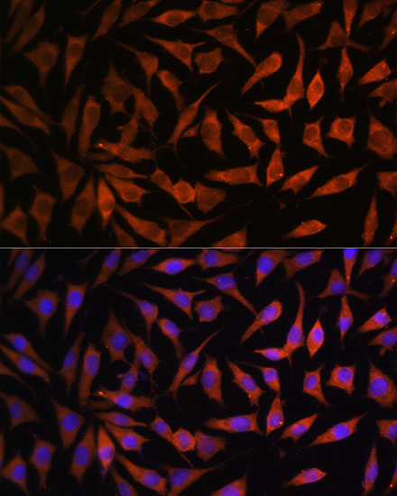 RPS8 Rabbit polyclonal antibody