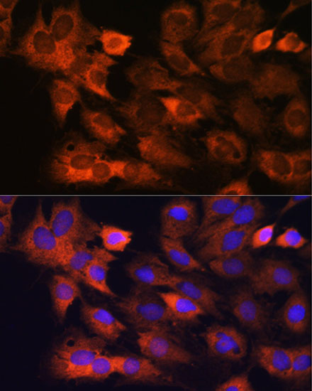 RPS8 Rabbit polyclonal antibody