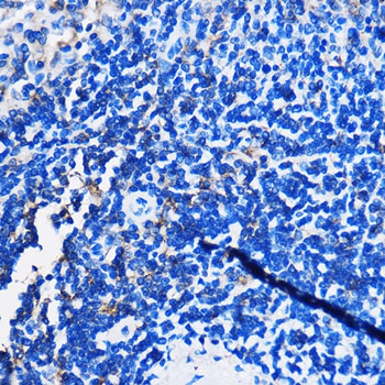 HCAR3 Rabbit polyclonal antibody
