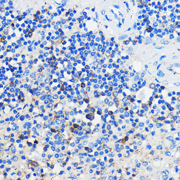 HCAR3 Rabbit polyclonal antibody