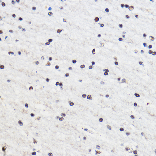 GTF3C3 Rabbit polyclonal antibody
