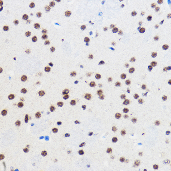 GTF3C3 Rabbit polyclonal antibody