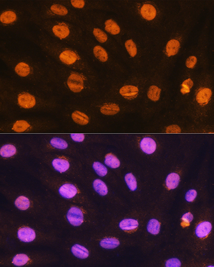 GTF3C3 Rabbit polyclonal antibody