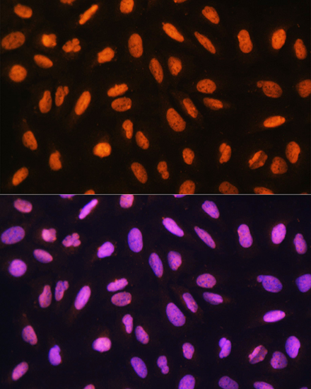 GTF3C3 Rabbit polyclonal antibody