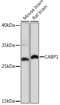 CABP1 Rabbit polyclonal antibody