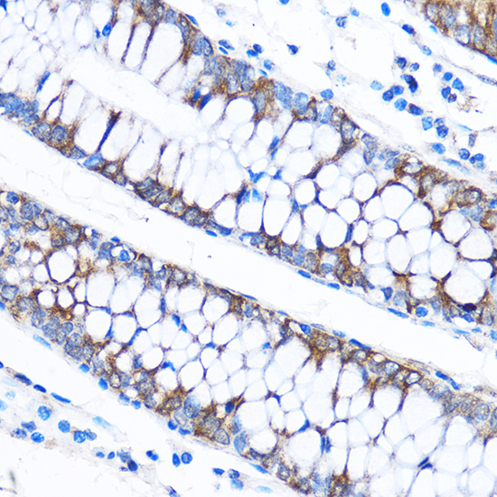 CABP1 Rabbit polyclonal antibody