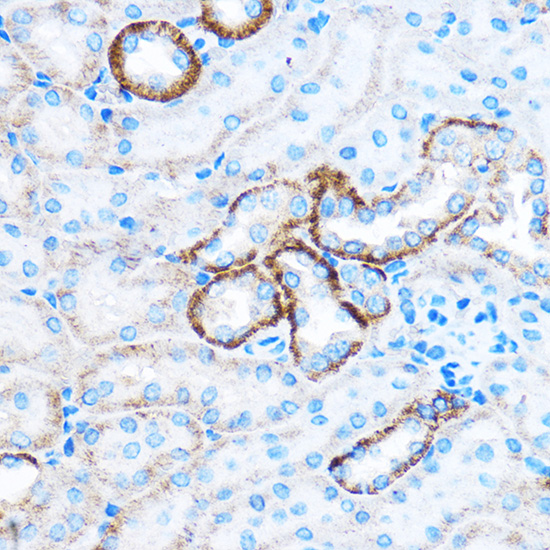 CABP1 Rabbit polyclonal antibody
