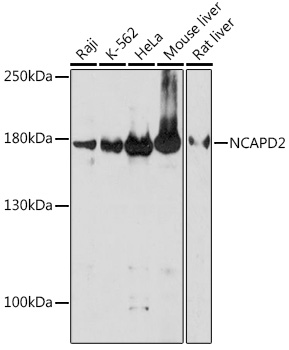 NCAPD2 Rabbit polyclonal antibody