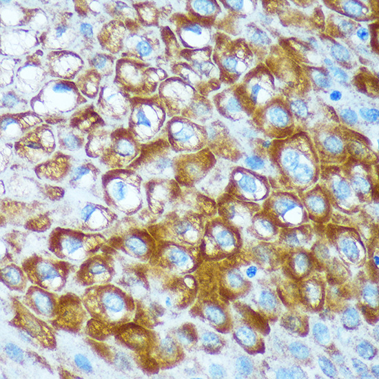 RCE1 Rabbit polyclonal antibody